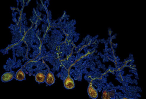 microscopy image 