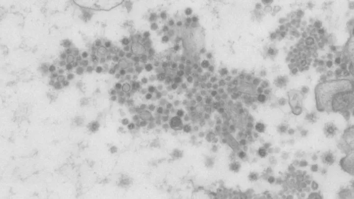 image shows part of the wider view of SARS-CoV-2 in human intestinal cells